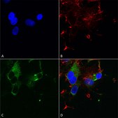 Monoclonal Anti-CACNA1D antibody produced in mouse clone S48A-9, 1 mg/mL, purified immunoglobulin