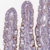 Anti-ACE antibody produced in rabbit Prestige Antibodies® Powered by Atlas Antibodies, affinity isolated antibody, buffered aqueous glycerol solution