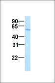 Anti-RUVBL1 antibody produced in rabbit affinity isolated antibody