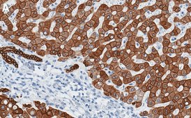 Anti-Cytokeratin 18 Antibody, clone 1G20 ZooMAb® Rabbit Monoclonal recombinant, expressed in HEK 293 cells