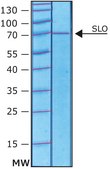 Streptolysin O from Streptococcus pyogenes γ-irradiated