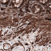 Monoclonal Anti-ACTB antibody produced in mouse Prestige Antibodies® Powered by Atlas Antibodies, clone CL3868, purified immunoglobulin, buffered aqueous glycerol solution