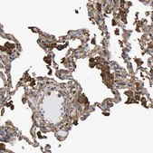 Anti-LIF antibody produced in rabbit Prestige Antibodies® Powered by Atlas Antibodies, affinity isolated antibody, buffered aqueous glycerol solution