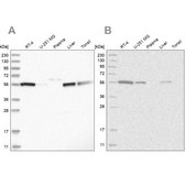 Anti-ALDH5A1 antibody produced in rabbit Prestige Antibodies® Powered by Atlas Antibodies, affinity isolated antibody, buffered aqueous glycerol solution, ab1