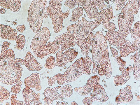 Monoclonal Anti-Vascular Endothelial Growth Factor Receptor-1 antibody produced in mouse clone FLT-19, tissue culture supernatant
