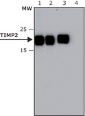 Anti-TIMP2 antibody, Mouse monoclonal clone TM8, purified from hybridoma cell culture