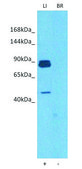 Anti-MTTP (C-terminal) antibody produced in rabbit affinity isolated antibody