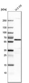 Anti-YES1 antibody produced in rabbit Prestige Antibodies® Powered by Atlas Antibodies, affinity isolated antibody, buffered aqueous glycerol solution