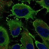 Anti-PDE3A antibody produced in rabbit Prestige Antibodies® Powered by Atlas Antibodies, affinity isolated antibody, buffered aqueous glycerol solution