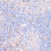 Anti-MMP9 antibody produced in rabbit