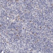Anti-FGR antibody produced in rabbit Prestige Antibodies® Powered by Atlas Antibodies, affinity isolated antibody, buffered aqueous glycerol solution