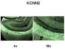 Anti-KCNN2 antibody produced in rabbit IgG fraction of antiserum
