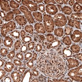 抗-GAPDH单克隆抗体 小鼠抗 Prestige Antibodies® Powered by Atlas Antibodies, clone CL3266, purified immunoglobulin, buffered aqueous glycerol solution