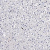 Anti-POLA1 antibody produced in rabbit Prestige Antibodies® Powered by Atlas Antibodies, affinity isolated antibody, buffered aqueous glycerol solution