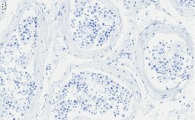 Anti-Anillin Antibody, clone 2C6 ZooMAb® Rabbit Monoclonal recombinant, expressed in HEK 293 cells