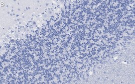 Anti-Synapsin-1 Antibody, clone 1G5 ZooMAb® Rabbit Monoclonal recombinant, expressed in HEK 293 cells