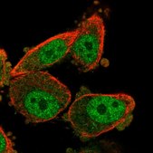 Anti-WT1 antibody produced in rabbit Prestige Antibodies® Powered by Atlas Antibodies, affinity isolated antibody