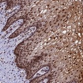 Anti-TADA3 antibody produced in rabbit Prestige Antibodies® Powered by Atlas Antibodies, affinity isolated antibody, buffered aqueous glycerol solution