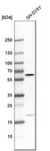 Anti-AKT3 antibody produced in rabbit Prestige Antibodies® Powered by Atlas Antibodies, affinity isolated antibody, buffered aqueous glycerol solution