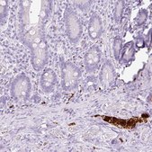 Anti-PRPH antibody produced in rabbit Prestige Antibodies® Powered by Atlas Antibodies, affinity isolated antibody, buffered aqueous glycerol solution