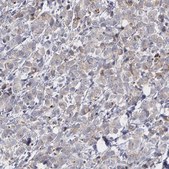 抗-ERBB2 兔抗 Ab1, Prestige Antibodies® Powered by Atlas Antibodies, affinity isolated antibody, buffered aqueous glycerol solution