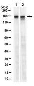 Anti-LATS1 Antibody, clone 9A3.1 clone 9A3.1, from mouse