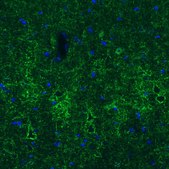Monoclonal Anti-GAD1 antibody produced in mouse Prestige Antibodies® Powered by Atlas Antibodies, clone CL2919, purified immunoglobulin, buffered aqueous glycerol solution