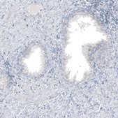 Monoclonal Anti-GLS2 antibody produced in mouse Prestige Antibodies® Powered by Atlas Antibodies, clone CL7721, purified immunoglobulin, buffered aqueous glycerol solution