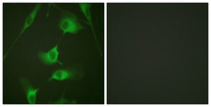 Anti-Keratin 8 antibody produced in rabbit affinity isolated antibody