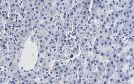 Anti-β-Glucocerebrosidase Antibody, clone 2I15 ZooMAb® Rabbit Monoclonal recombinant, expressed in HEK 293 cells