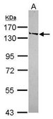 Anti-SMC6 antibody produced in rabbit affinity isolated antibody, buffered aqueous solution