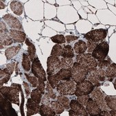 Monoclonal Anti-CS antibody produced in mouse Prestige Antibodies® Powered by Atlas Antibodies, clone CL2579, purified immunoglobulin, buffered aqueous glycerol solution