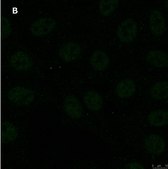 Anti-GST Antibody, clone 5B8 , ZooMAb® Rabbit Monoclonal recombinant, expressed in HEK 293 cells