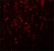 Anti-LXR-A antibody produced in rabbit affinity isolated antibody, buffered aqueous solution