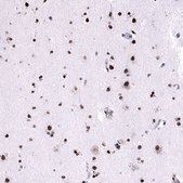 Monoclonal Anti-FOXM1 antibody produced in mouse Prestige Antibodies® Powered by Atlas Antibodies, clone CL12131, purified immunoglobulin, buffered aqueous glycerol solution