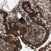 Anti-ATIC antibody produced in rabbit Prestige Antibodies® Powered by Atlas Antibodies, affinity isolated antibody, buffered aqueous glycerol solution