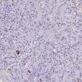Anti-F2 antibody produced in rabbit Prestige Antibodies® Powered by Atlas Antibodies, affinity isolated antibody, buffered aqueous glycerol solution