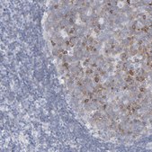 Anti-P2RY8 antibody produced in rabbit Prestige Antibodies® Powered by Atlas Antibodies, affinity isolated antibody, buffered aqueous glycerol solution