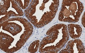 Anti-PSA Antibody, clone 1E10 ZooMAb® Rabbit Monoclonal recombinant, expressed in HEK 293 cells