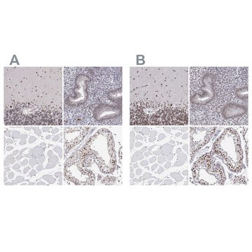 Anti-ADAR antibody produced in rabbit Prestige Antibodies® Powered by Atlas Antibodies, affinity isolated antibody, buffered aqueous glycerol solution
