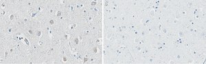 Anti-APP Antibody, clone 1F22 ZooMAb® Rabbit Monoclonal recombinant, expressed in HEK 293 cells