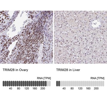 Anti-TRIM28 antibody produced in rabbit Prestige Antibodies® Powered by Atlas Antibodies, affinity isolated antibody, buffered aqueous glycerol solution