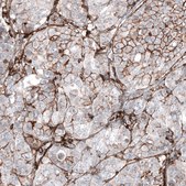 Anti-CD44 antibody produced in mouse Prestige Antibodies® Powered by Atlas Antibodies, clone CL13319, purified by using Protein A, buffered aqueous glycerol solution