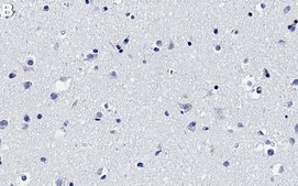 Anti-MFF Antibody, clone 1E18 ZooMAb® Rabbit Monoclonal recombinant, expressed in HEK 293 cells