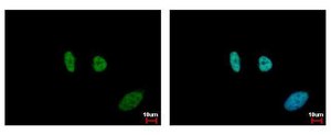 Anti-SMC6 antibody produced in rabbit affinity isolated antibody, buffered aqueous solution