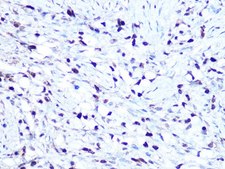 Anti-HMGA1 antibody produced in rabbit