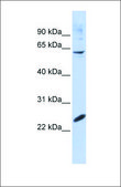 Anti-SMAD4 antibody produced in rabbit affinity isolated antibody