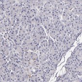 Anti-TLR8 antibody produced in rabbit Prestige Antibodies® Powered by Atlas Antibodies, affinity isolated antibody, buffered aqueous glycerol solution