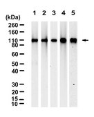 Anti-α-Actinin-1 Antibody, clone 2C17 ZooMAb® Rabbit Monoclonal recombinant, expressed in HEK 293 cells