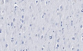 Anti-TOMM20 Antibody, clone 5H22 ZooMAb® Rabbit Monoclonal recombinant, expressed in HEK 293 cells